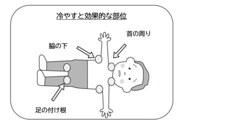 冷やすと効果的な部位
